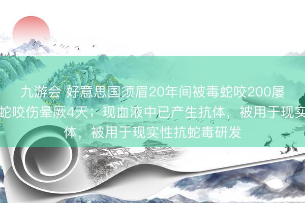 九游会 好意思国须眉20年间被毒蛇咬200屡次，曾被眼镜蛇咬伤晕厥4天；现血液中已产生抗体，被用于现实性抗蛇毒研发